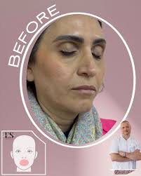 Instagram photo by Dr Eli Shulman • aesthetic & beauty • Feb 12, 2025 at  2:59 AM