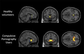 Pornography addiction leads to same brain activity as alcoholism or drug  abuse, study shows | The Independent | The Independent