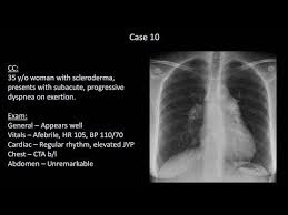 How To Interpret A Chest X Ray Lesson 10 Self Assessment Part 2 Youtube In 2020 Self Assessment X Ray Assessment