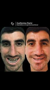 Guillermo Parisi