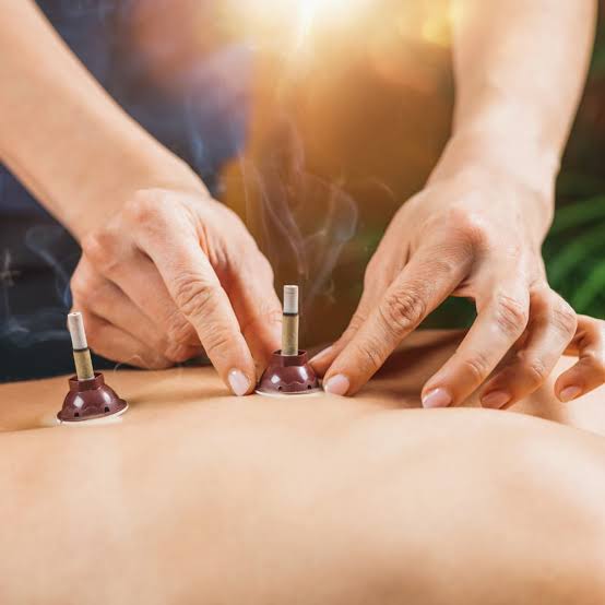 What moxibustion feels like at Yuan Qi Acupuncture Center, Dubai