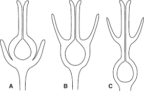 Classification of flowers based on position of ovary. American Journal Of Botany