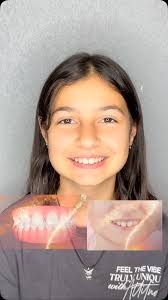 Uzm. Dt. Halil Toros Bingöl