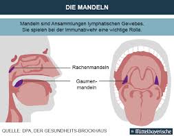 Die mandeln werden mithilfe spezieller instrumente in etwa 15 bis 30 minuten operiert. Wann Die Mandeln Rausmussen Gesundheit Nachrichten Mittelbayerische