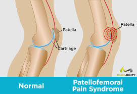 Pin On Knee