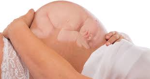 Account Suspended Breech Babies 31 Weeks Pregnant Baby Position