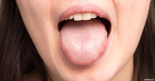 نبات ، قلب نازف ، شجيرة ، ربيع ، الزهور على شكل قلب ، زهري ، أبيض ، مشرق ، رومانسي ، طبيعة ، حديقة تنزيل مجاني 8 Ø£Ø³Ø¨Ø§Ø¨ Ù„Ø¬ÙØ§Ù Ø§Ù„Ù„Ø³Ø§Ù† Ø³ÙˆØ¨Ø± Ù…Ø§Ù…Ø§