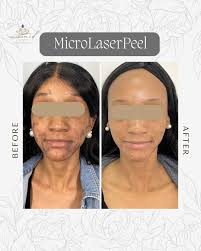 A Lash Lift and Lash Tint is the perfect dynamic duo to elevate, curl, and  color your lashes in just one convenient appointment! 🙌✨ It instantly  brightens and awakens your eye area,