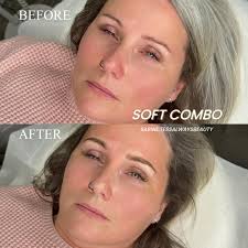 Ok group look at my eyebrows. I need them fuller. They are getting thin as  I age gracefully 🤷‍♂️🤗