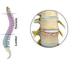 Image result for Lumbar vertebrae