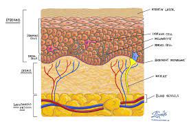 Updated by a/prof amanda oakley, hamilton, new zealand. Merkel Cell Carcinoma Mypathologyreport Ca