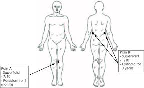 body chart of the patient after subjective examination