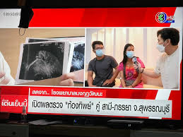 จากกรณี สาวท้องลูกแฝด 2 โรงพยาบาลแจงวุ่น หญิง ท้องทิพย์ อ้างคลอดลูกแฝดชายหญิงแล้วลูกชายตาย ไปรับศพมีผ้าห่อมิดชิดเมื่อเปิดดูพบเพียงผ้า 4 ผืน. Tqsxm8tinvltom