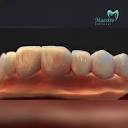 Maestro Dental Lab (@maestro.dental.lab) • Instagram photos and videos