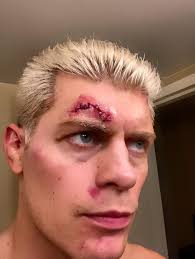 Cody Rhodes' battle scar from Full Gear is no joke 😳😳