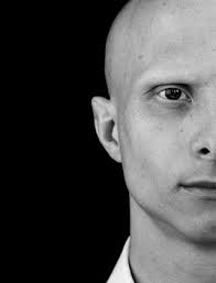 This type of hair loss often happens suddenly. The Belgravia Centre Alopecia Universalis Black Women Hair Loss Alopecia Eyebrows