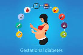 Gestational diabetes generally results in few symptoms; What Is Gestational Diabetes Diabetes In Pregnant Women Diabnext