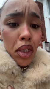 How to Fix a Black Blob