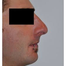 a) Photograph of the patient preoperatively. (b) Using visual...