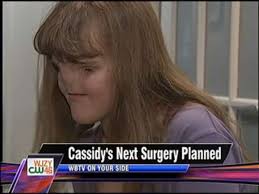 Per gli occhi purtroppo non sono molte le possibilità della medicina, visto che al viso di Cassidy mancano entrambi i bulbi oculari. - 20130726_51255_9984113_bg1