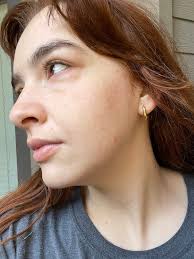 Alternatives to NSAIDs for tooth pain relief?