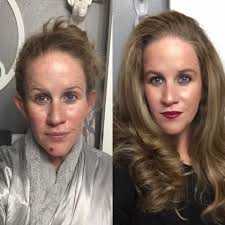 Sharing the LimeLight