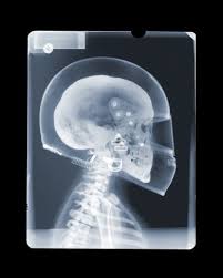 F1 Headshot Ap C Print Diasec 33 X 26 Xray Art Graphic Design Background Templates X Ray