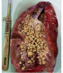 Suruh saya cuba jus gh ni sbb tak terperi sgt, nk tunggu turn operation lamaaaa sgt. Rawat Batu Karang Shidarahmat