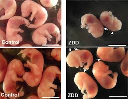 Zinc Deficiency Before Conception Disrupts Fetal Development Penn State University
