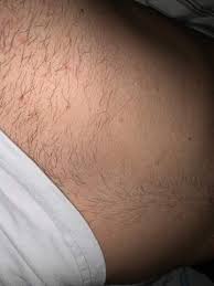This page includes the following topics and synonyms: Ist Das Syphilis Gesundheit Und Medizin Sex Geschlechtskrankheiten