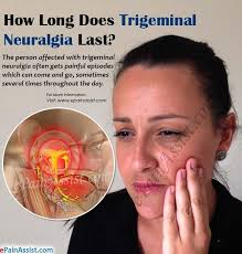 How Long Does Trigeminal Neuralgia Last Trigeminal Neuralgia Treatment Neuralgia Treatment Trigeminal Neuralgia