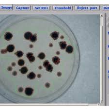 Non potrei tanto dirvene che non restasse piú a dirvene. Pdf A Comprehensive Review Of Image Analysis Methods For Microorganism Counting From Classical Image Processing To Deep Learning Approaches
