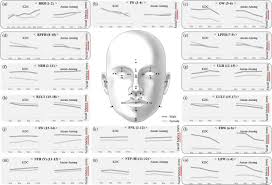He was drafted into the army from new. The Age Distribution Of Facial Metrics In Two Large Korean Populations Scientific Reports