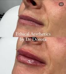 Ritual MCR Hair Nails Beauty