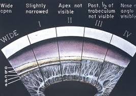 Image result for Gonioscopy
