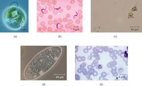 Briefly state why viruses are not considered as prokaryotic nor. Unique Characteristics Of Eukaryotic Cells Microbiology