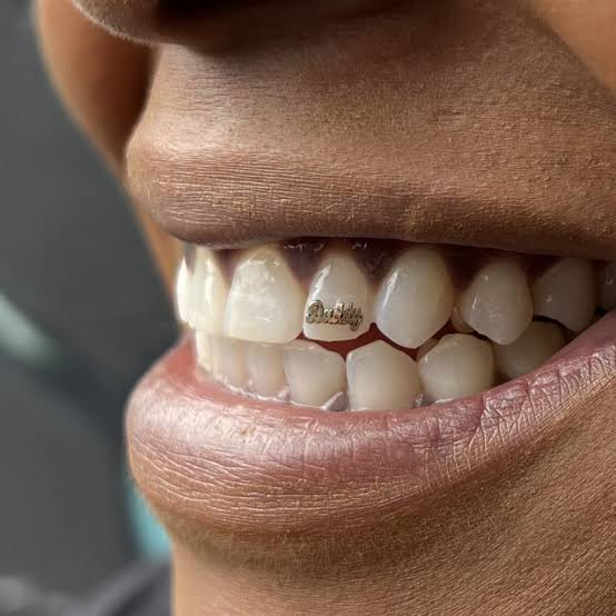Tooth jewellery
