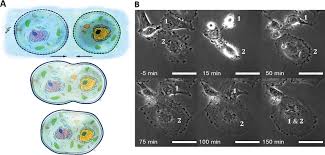 High-Voltage Electrical Pulses in Oncology: Irreversible Electroporation,  Electrochemotherapy, Gene Electrotransfer, Electrofusion, and  ElectroimmunotherapyRadiology