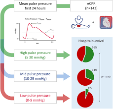 Image result for Pulse Pressure