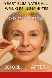 Yeast removes wrinkles in 3 minutes