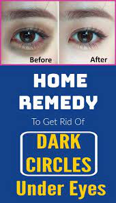 Home Remedy To Get Rid Of Dark Circles Under Eyes Skin Darkcircles Darkskin Skincare Skincaretips Dark Circles Under Eyes Dark Circles Remove Dark Circles