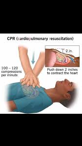 Image result for Chest Compressions