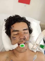 Zona Radio-Joaquín Aragón...