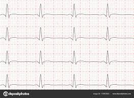 Cardiogram Of Heart Beat Ecg On Chart Paper Vector