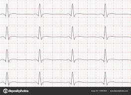 Cardiogram Of Heart Beat Ecg On Chart Paper Vector