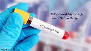 Mpv Blood Test