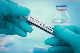 Per chi è adatto il test rapido anziché il tampone classico? Coronavirus Como Funcionam Os Testes Rapidos Que Detectam Anticorpos Vivabem Uol Vivabem