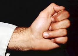 May be able to palpate flexor tendon retracted proximally along flexor sheath. Jersey Finger Clinicians Classroom Bracelab