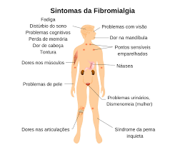 O que a comunidade médica sabe é que essa doença ocorre porque o cérebro do paciente interpreta o sinal de dor com muito mais intensidade, provocando as crises de diferentes intensidades e duração. Post Dr Ernani Abreu L Especialista Em Coluna