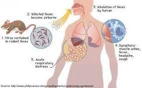 We did not find results for: Rodents And Hantavirus Pulmonary Syndrome Massey Services Inc